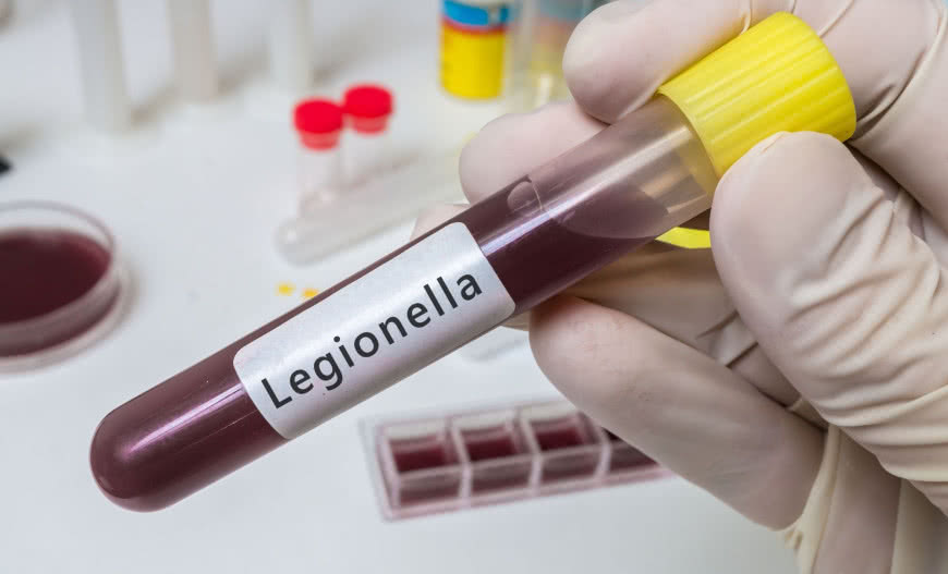 Sposoby zapobiegania bakteriom Legionella w instalacjach